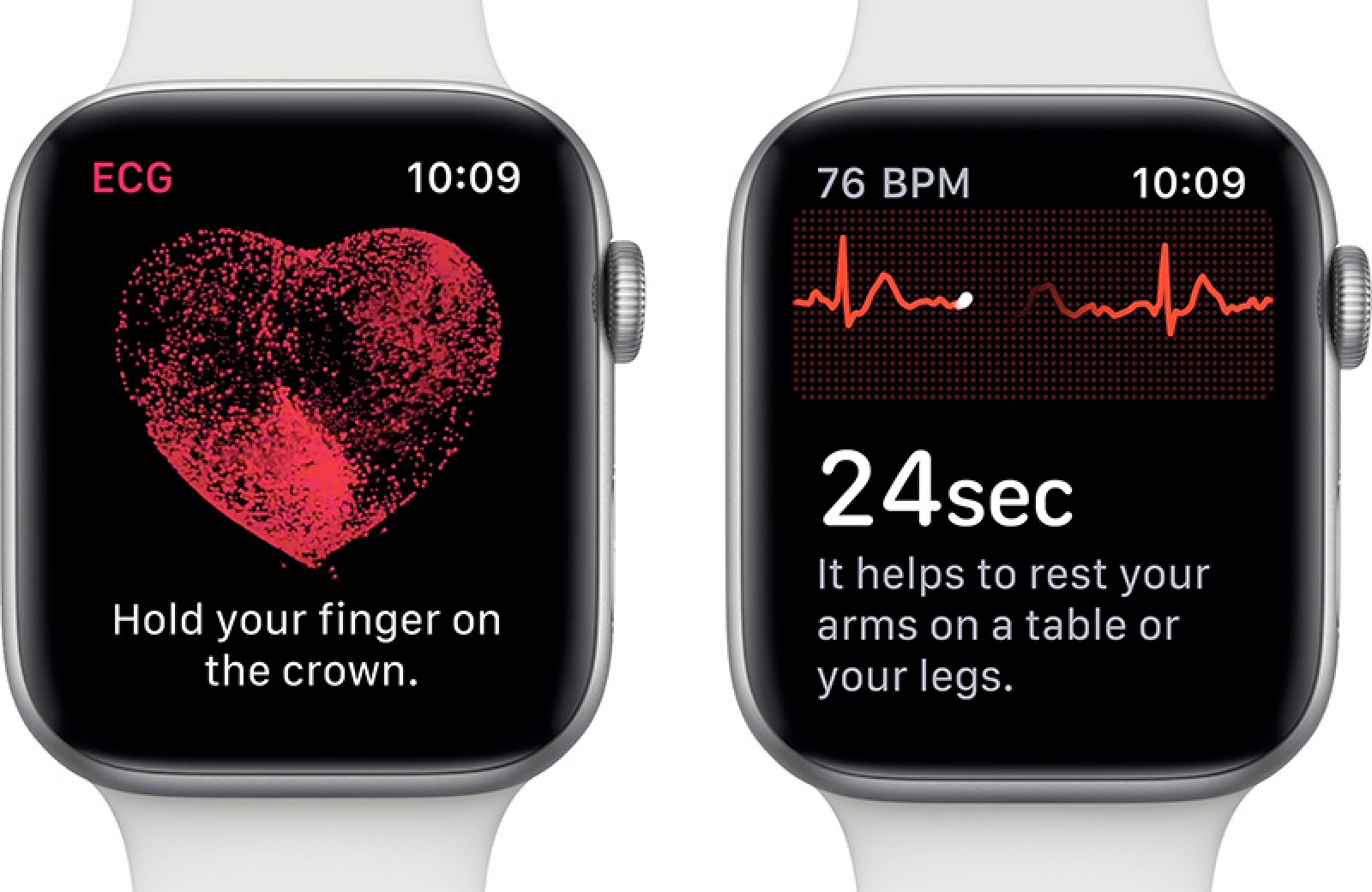 Studi Apple Watch Hasilkan Kualitas EKG-12 Terbaik