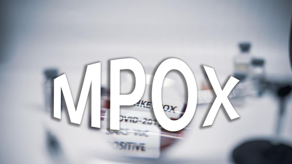 Kasus Cacar Mpox di RI Kini Tembus 30 Kasus